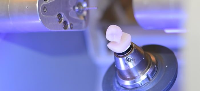 facette CEREC