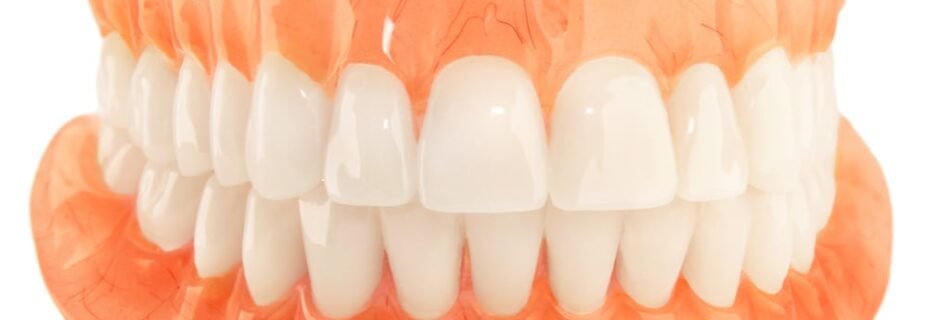 implant dentaire arcade complete