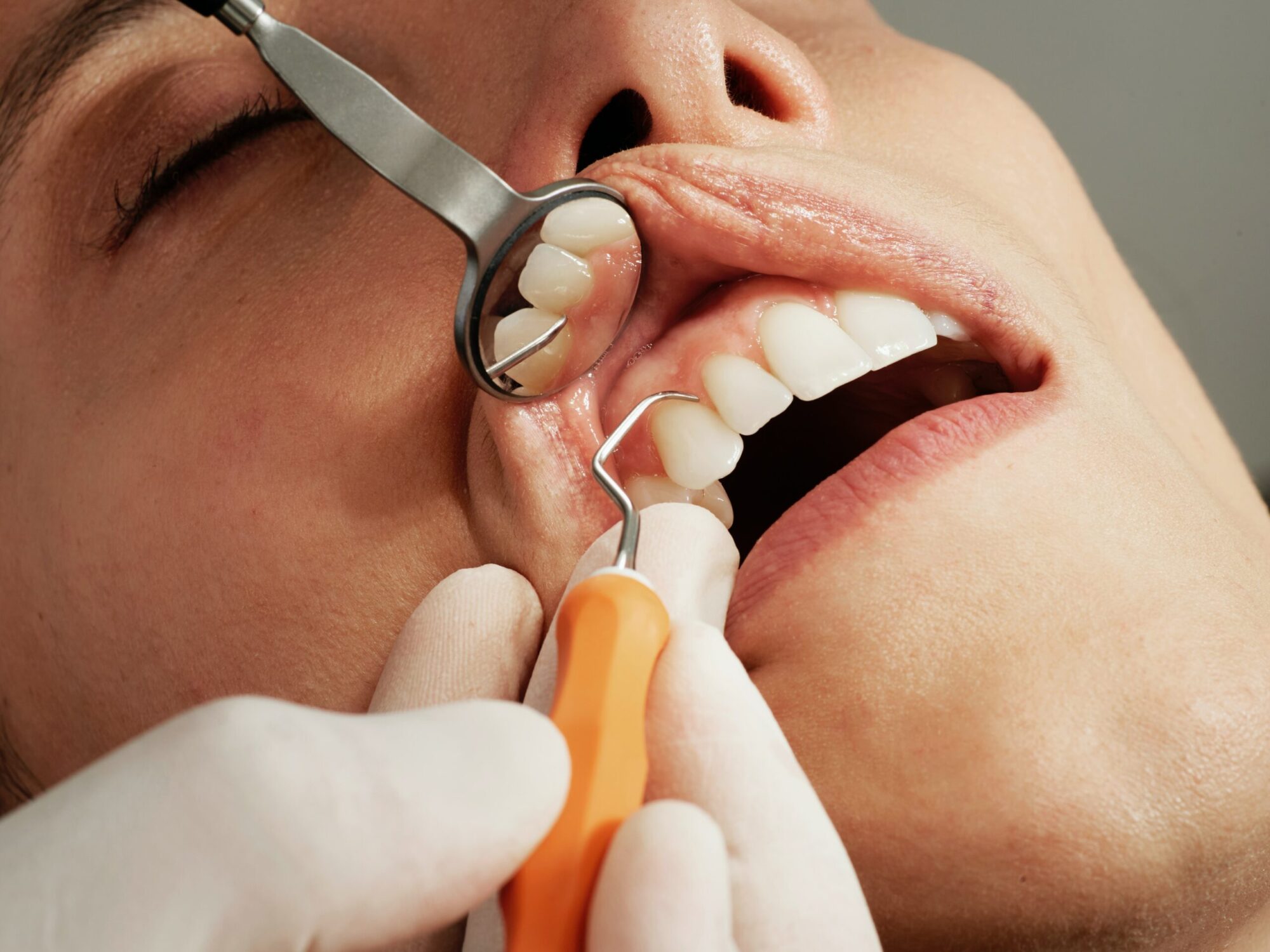 magnesium sante des dents