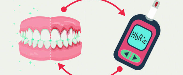 Parodontite et le Diabète