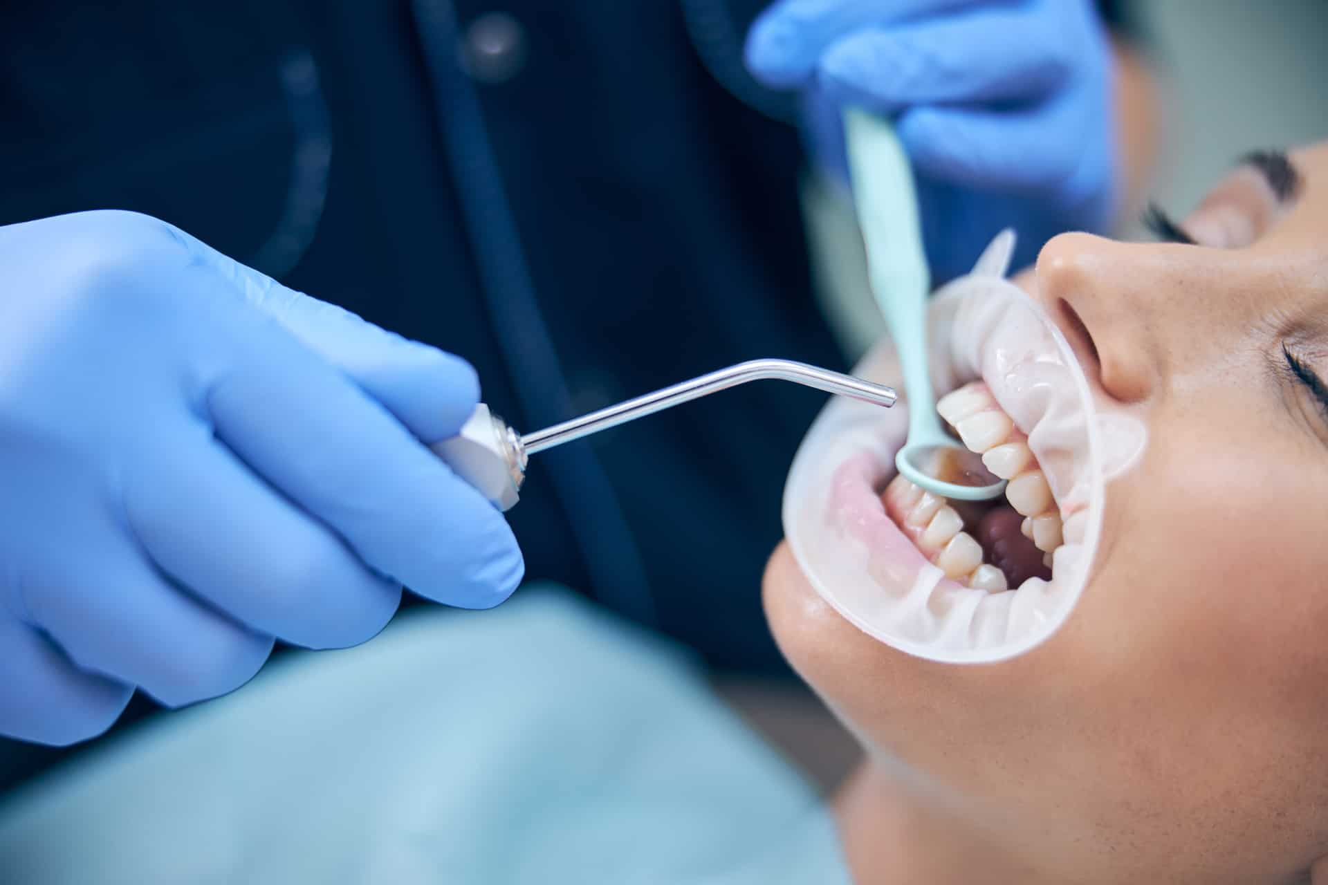 apnee-sommeil-effet-dentition