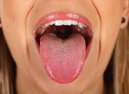 cancer bouche