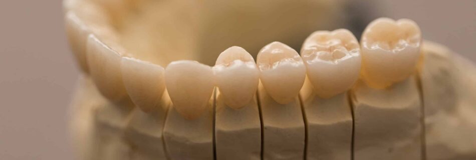 couronne ceramo ceramique
