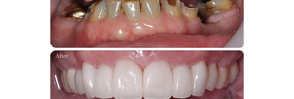smile makeover tunisie