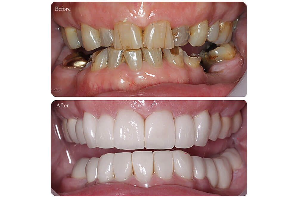 smile makeover tunisie